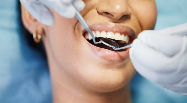 Best Emergency Dental Extractions in Somerset, OH