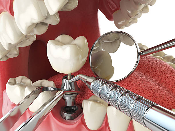 Best Weekend Emergency Dentist in Somerset, OH